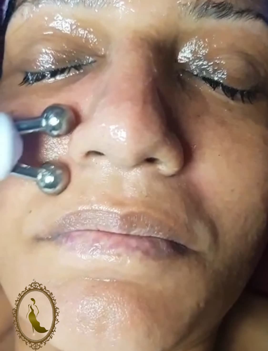 Hydrafacial Radio Frequency Step