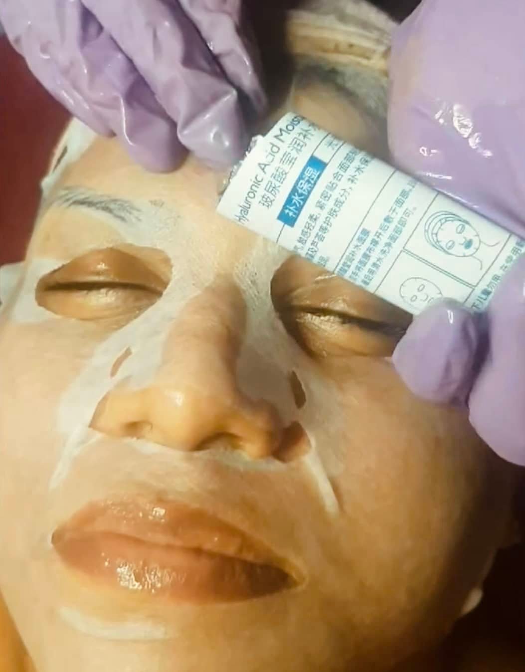 Hydrafacial treatment procedure