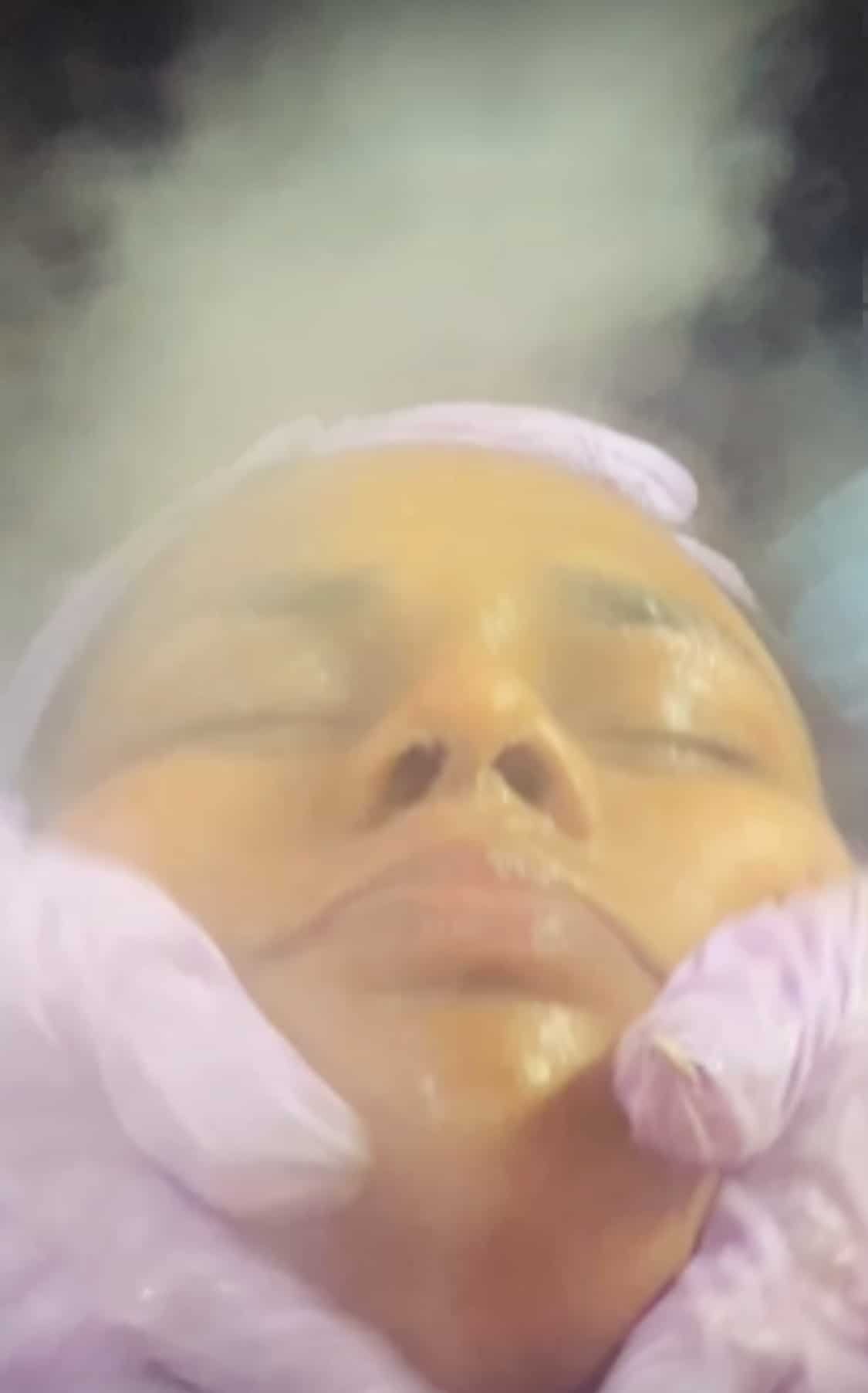 Hydrafacial treatment process