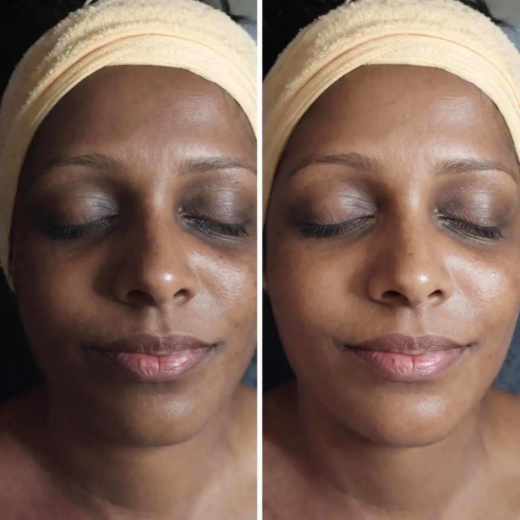 Before and after — visible glow in just one session (2025/12/15)